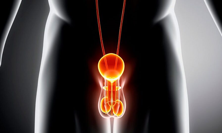 Entzündetes Genitourinesystem bei Prostatitis